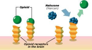 How Medication-Assisted Treatments like Naloxone Works